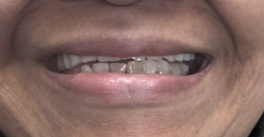 Before