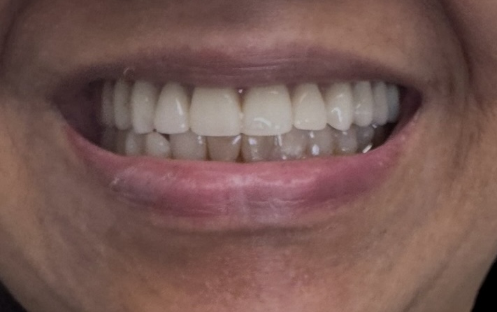 After